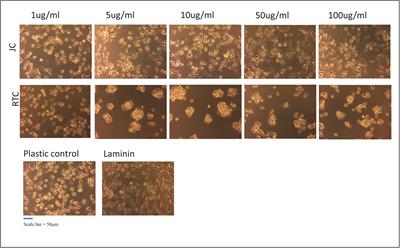 The Biological Evaluation of Jellyfish Collagen as a New Research Tool for the Growth and Culture of iPSC Derived Microglia